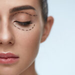 Eyelid-Surgery-in-Riyadh-6.jpg