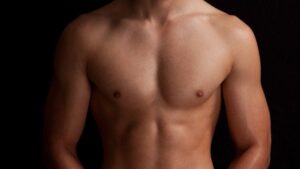Common Myths About Gynecomastia Surgery in Islamabad