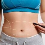 Is-Tummy-Tuck-Surgery-Safe-for-Everyone.jpg