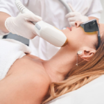 Laser-Skin-Tightening-for-Post-Pregnancy-Skin-Rejuvenation.png