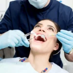 Teeth-Cleaning-and-Polishing-in-Riyadh-5.webp