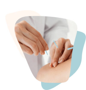 Getting Acupuncture? Avoid These Mistakes for a Better Experience