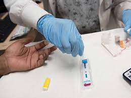 Protect Your Health with Free HIV Screening Services