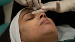 The Power of Advanced Aesthetic Solutions: Elevate Your Skin with Modern Laser Treatments