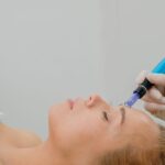 microneedling-naples-florida.jpg