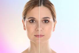 Exploring NMN Before and After: Does It Really Make a Difference?