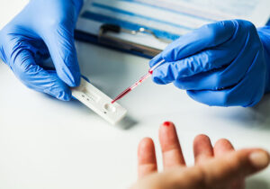 Affordable HIV Care and Testing Options