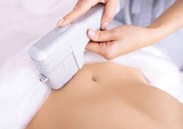 Can HIFU Be Used to Tighten Skin on the Abdomen?