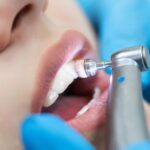 Can-Teeth-Cleaning-Prevent-Tooth-Sensitivity-Heres-the-Answer.jpg