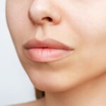 Can-Volbella-Smooth-Vertical-Lip-Lines.jpg