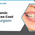 Ceramic-braces-cost.png