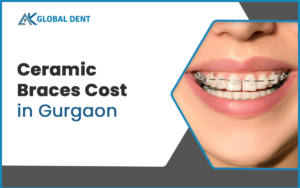 Braces- How They Help Correct Jaw Alignment?