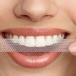 Crest-Teeth-Whitening-Strips-6.jpg