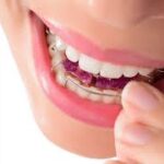Dont-let-teeth-move-back.jpg