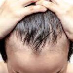 Finasteride-for-Hair-Loss-in-Dubai5.jpg