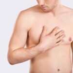 Gynecomastia-Surgery-in-Riyadh-55.jpg