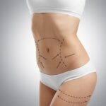 How-Does-a-Tummy-Tuck-Address-Loose-Skin.jpg