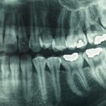 dental-xray-2.jpeg