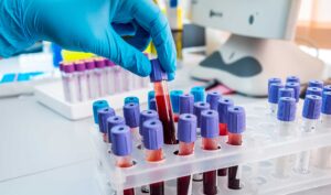 Cancer Treatment Lagos | Genesis Specialist Hospital
