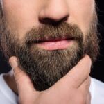 recovery-beard-transplants.jpg
