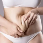 woman-tugging-at-belly-fat.webp