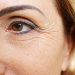 wrinkles1.png