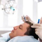 زراعة-الشعر-في-الرياض-10.jpg