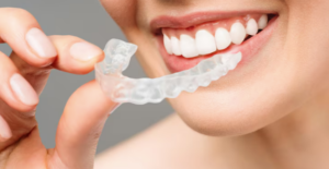Advancing Smiles with Modern Orthodontics
