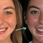 Contouring-gums-for-a-confident-smile.png