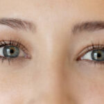 Eyelid-Lift-in-Riyadh-18.jpg