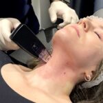 How-Does-Morpheus8-Address-Both-Wrinkles-and-Loose-Skin.jpg