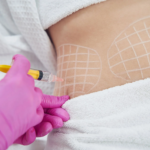 How-Effective-Are-Fat-Melting-Injections-for-Body-Sculpting.png
