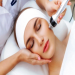 Is-RF-Treatment-a-Good-Option-for-Improving-Acne-Scars.png