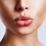 Laser-Treatment-for-Dark-Lips-in-Dubai.jpg