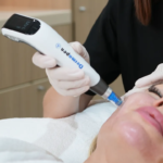 MESOTHERAPY-featured.png
