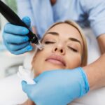 Microneedling-In-Dubai.jpg
