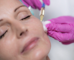 Can Polynucleotide Therapy Be Used for Facial Scars or Stretch Marks?