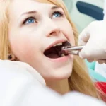 Surgical-Tooth-Removal-in-Islamabad.webp