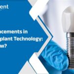 The-Advancements-in-Dental-Implant-Technology-Whats-New.jpg