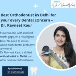Top-Braces-Treatment-in-Delhi-by-Dr.-Ravneet-Kaur-7.jpg