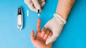 What to Expect on Your First Day of Blood Glucose Monitoring Training
