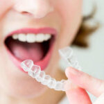 invisalign-aligner-removal-phoenix-orthodontist.jpg
