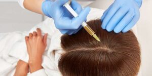 Who Can Get the Best PRP Hair Treatment in Dubai?