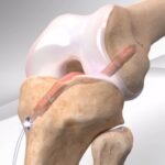 orthopedic.jpg