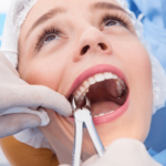 tooth-removal.png