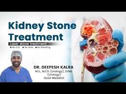 Comprehensive Guide to Urinary Bladder Cancer Treatment in Jaipur