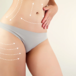 Best-Liposuction-Surgery-Cost-in-Dubai.png