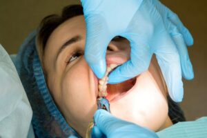 Wisdom Tooth Extraction Under Sedation: What Are Your Options?