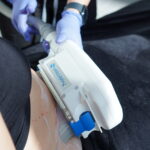 Can-CoolSculpting-Help-Sculpt-My-Hips.jpg