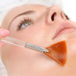 Can-Glycolic-Acid-Peels-Be-Performed-on-Body-Areas-Too.jpg
